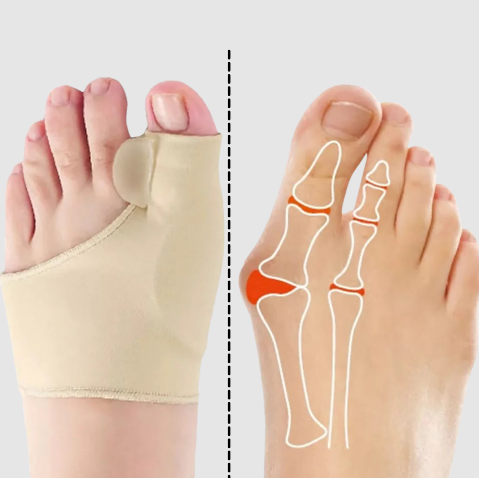 Gel Toe Corrector with Side Cushion Pad and Elastic Fabric, Beige Valideals Outlet