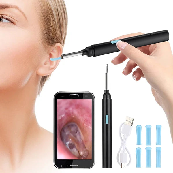 Ear Inspection Camera with 20X Magnification and Wireless App Control Valideals Outlet