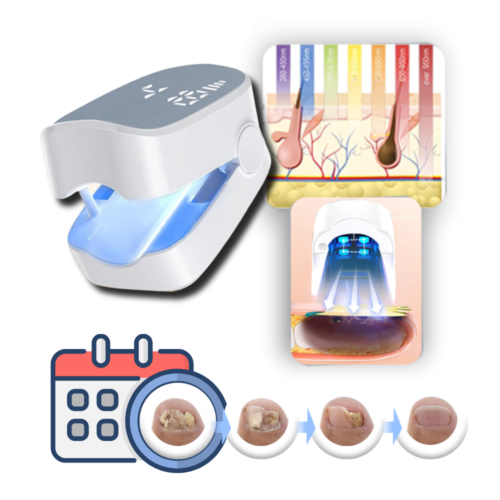 Dual Laser Nail Treatment Device with Pulsed Mode and 5mm Penetration Valideals Outlet