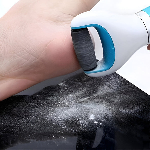 Rechargeable Foot Callus Remover with Rotating Abrasive Head and Detachable Design Valideals Outlet
