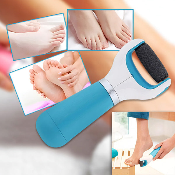 Rechargeable Foot Callus Remover with Rotating Abrasive Head and Detachable Design Valideals Outlet