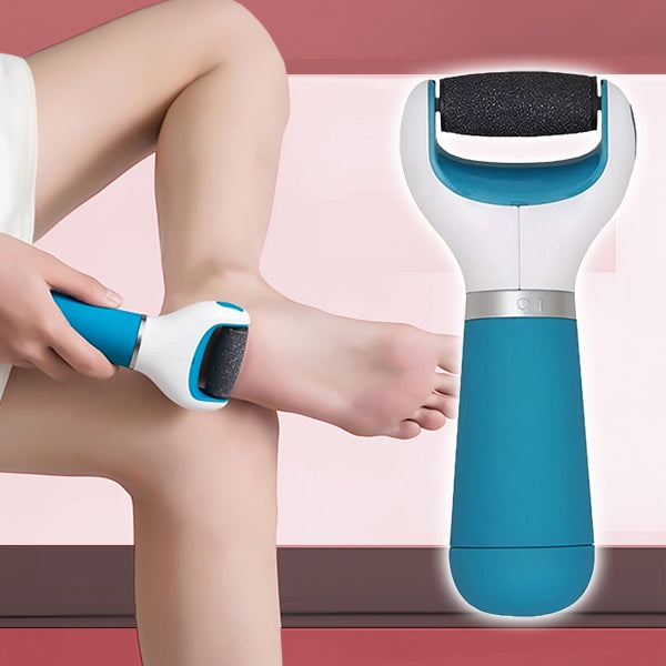 Rechargeable Foot Callus Remover with Rotating Abrasive Head and Detachable Design Valideals Outlet