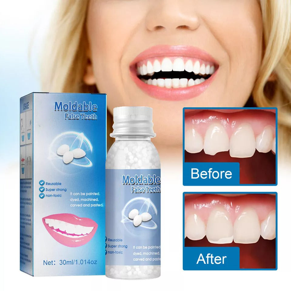 Moldable Tooth Repair Kit with Polymer Beads and Cold Water Setting Valideals Outlet