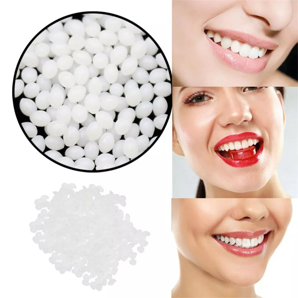 Moldable Tooth Repair Kit with Polymer Beads and Cold Water Setting Valideals Outlet